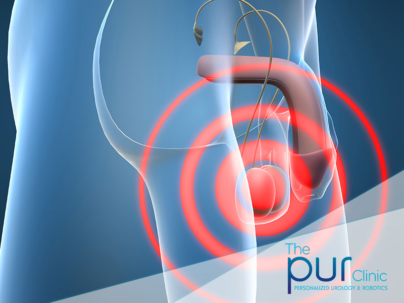 pur-clinic-testicular-pain